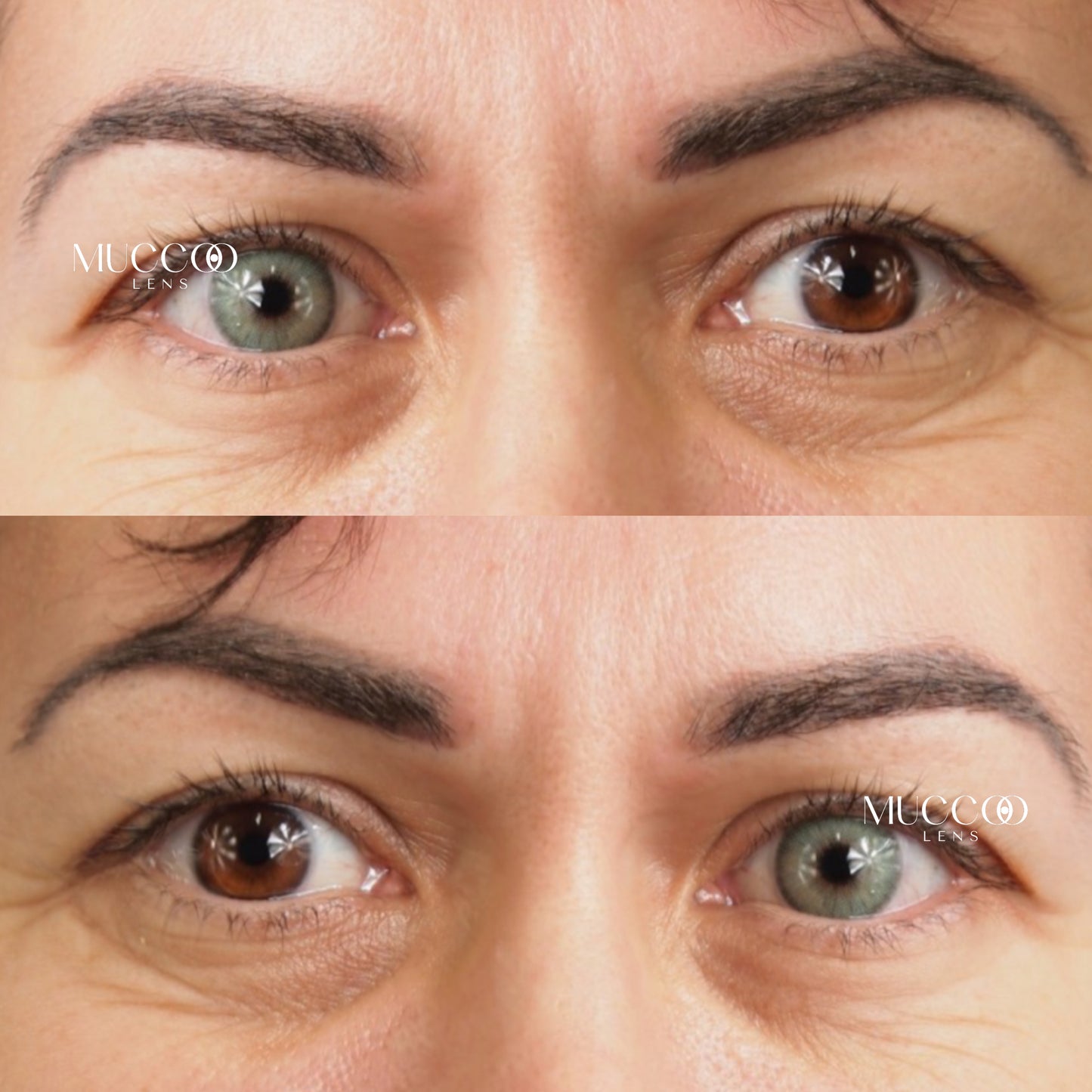 Anual pupila reduzida Gogh N Cinza (caixa com 2 unidades)